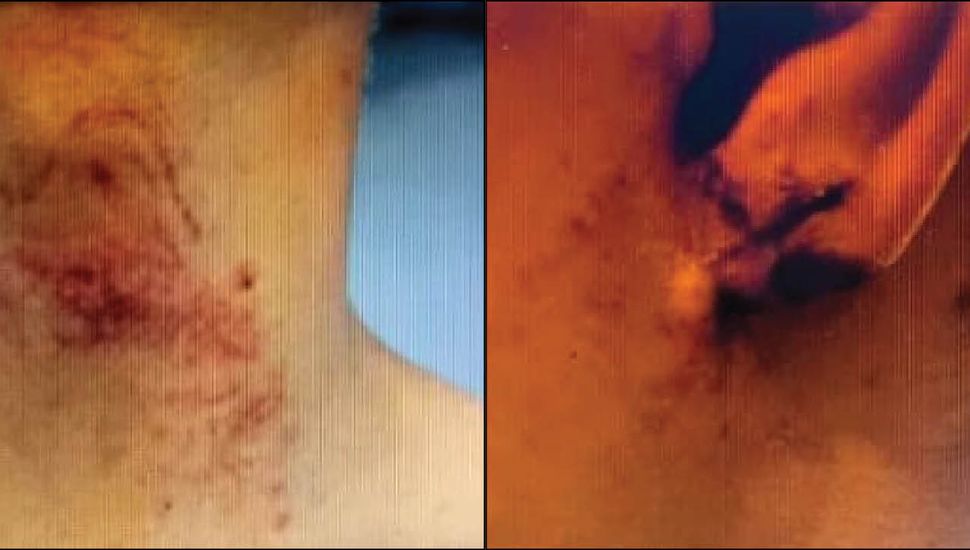 Continúa la investigación por el ataque a un peón rural que fue torturado y amenazado