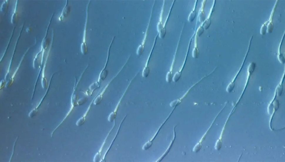 Un donante de esperma con mutación cancerígena engendró cerca de 200 niños