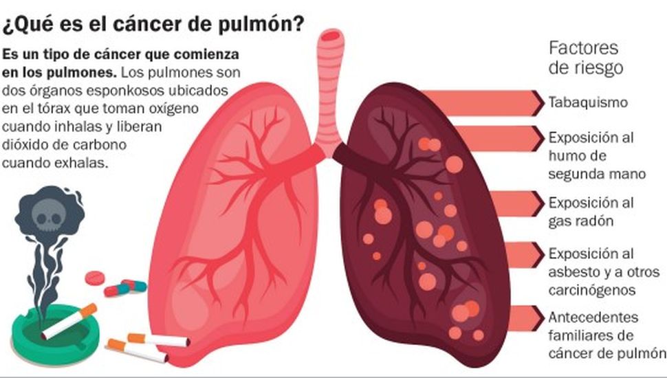 Cáncer de pulmón: contar con mejores posibilidades