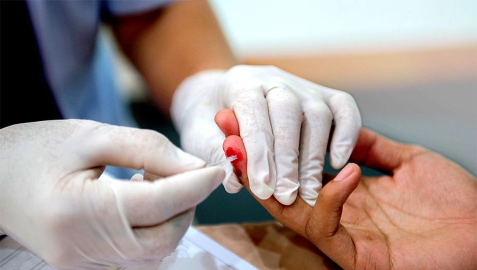 Más del 98% de las infecciones por VIH se producen por relaciones sexuales en Argentina