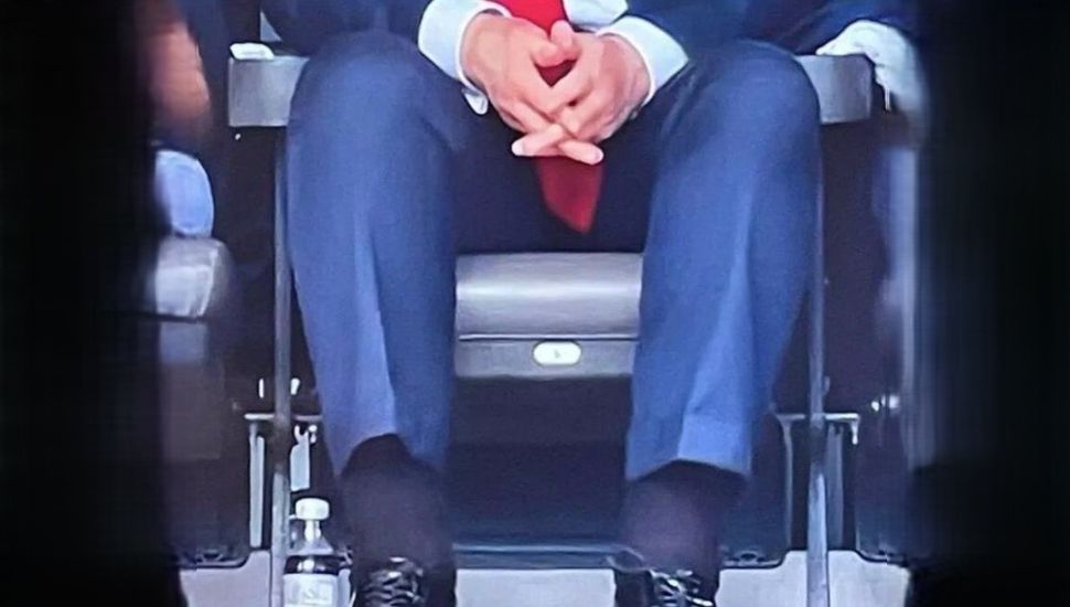 Le diagnostican a Trump insuficiencia venosa crónica