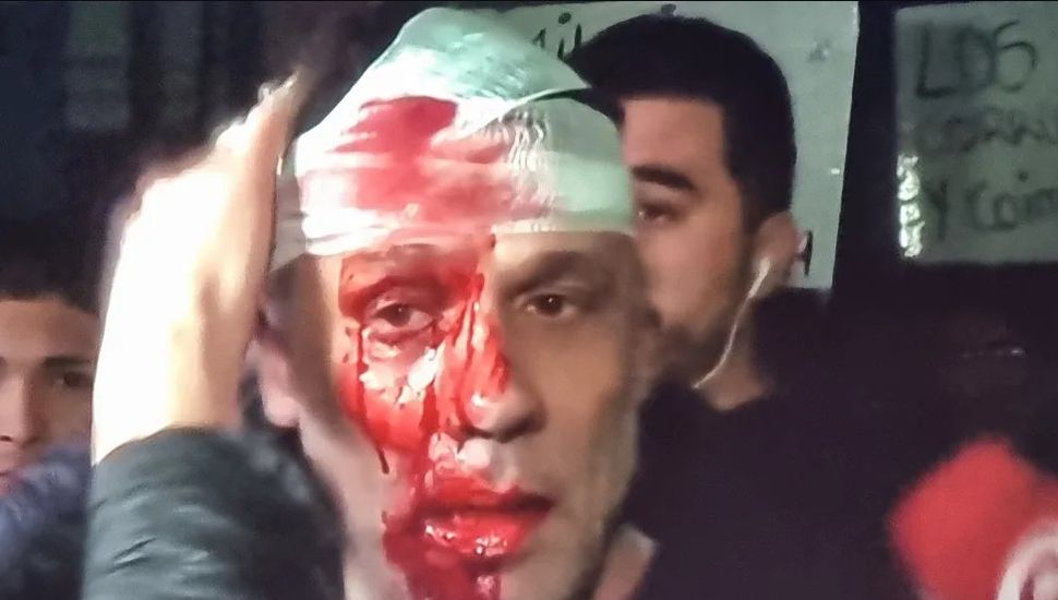 Le partieron la cara a un periodista de América TV durante el acto libertario en Moreno