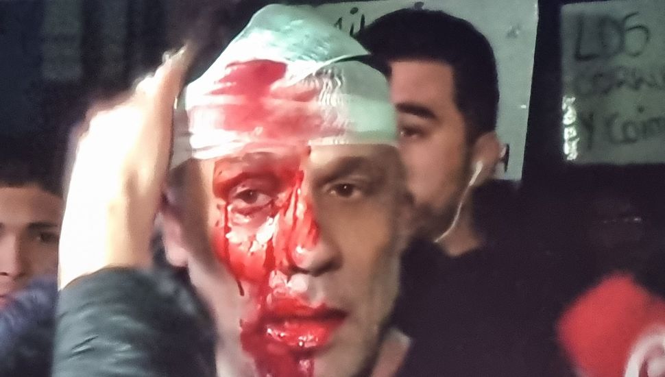 Un periodista herido durante el cierre de campaña de La Libertad Avanza