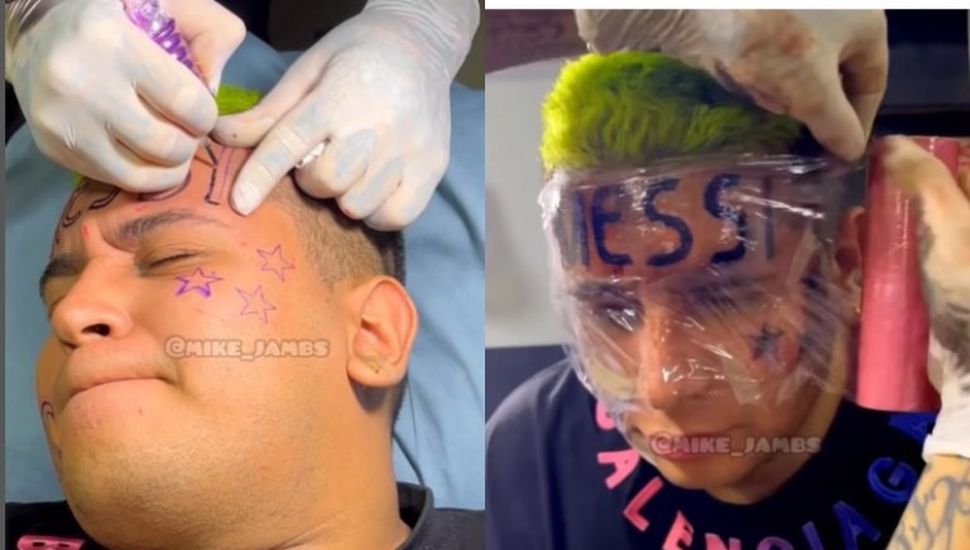 Un joven se tatuó a Messi en la frente y luego se arrepintió
