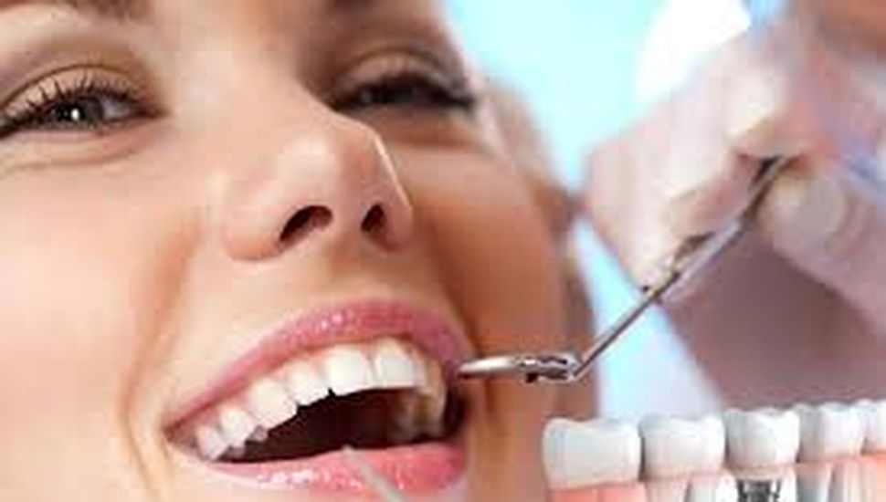 Ventajas y desventajas de los implantes dentales