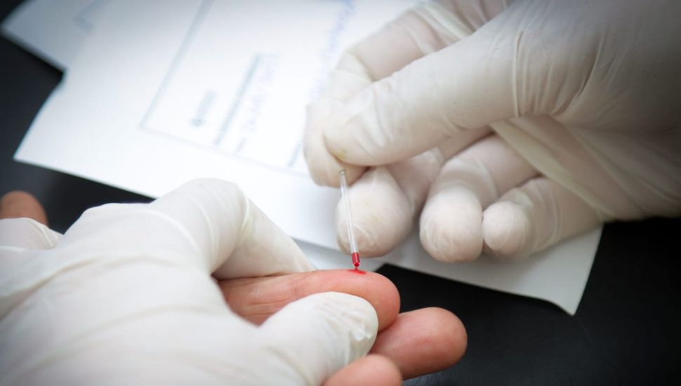 Testeos gratuitos de VIH en el Área de Diversidad