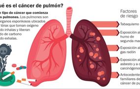 Cáncer de pulmón: contar con mejores posibilidades